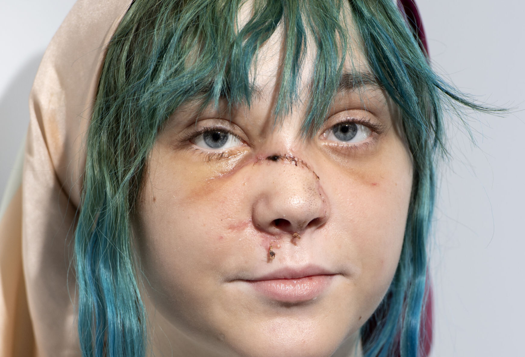 Elise Poole protest injury